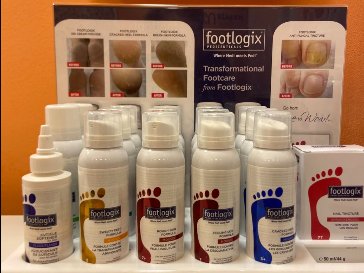Profesionální péče o nohy Footlogix v salonu Hotel Vista